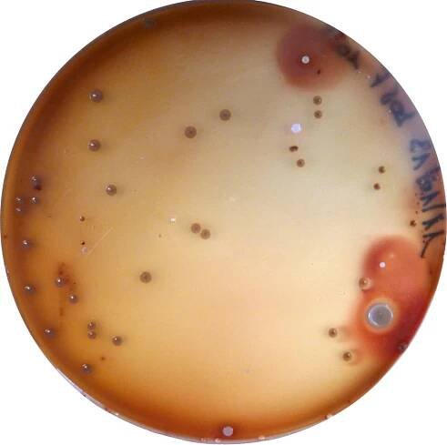 Underarm bacteria - Doctor Armpit