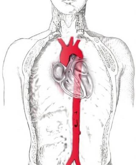Aorta – Wikipedie