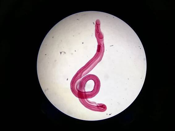 Schistosoma