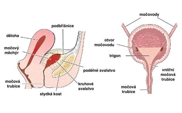 Syndrom bolestivého močového měchýře