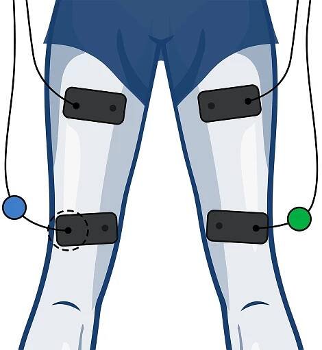 Female Wired Muscle Stimulator Electrode Placement - Hamstring 2 channels