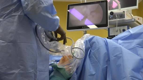 Anterior cruciate ligament reconstruction (ACL reconstruction) is a surgical tissue graft replacement of the anterior cruciate ligament, located in the knee, to restore its function after an injury. — Stock záběr