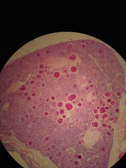 Obrázek - Mycobacterium | BioLib.cz