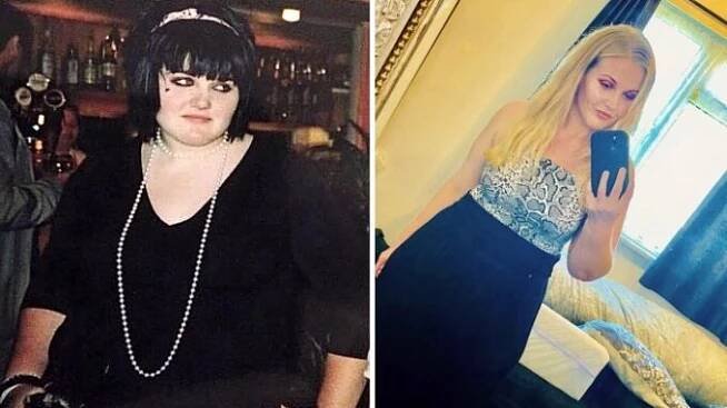 Zhubla 45 kilo, ale přebytečná kůže jí 10 let bránila najít lásku. Žena našetřila na operaci a její proměna bere dech