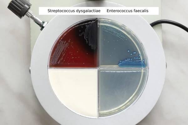 Streptococcus dysgalactiae