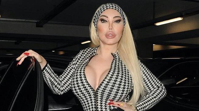 Jessica Alves podstoupila svou „poslední“ plastickou operaci z donucení. Hned předvedla výsledek - Super.cz