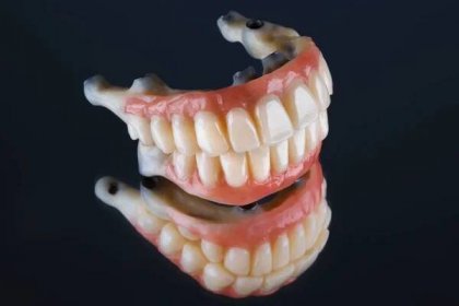 Vysoce kvalitní zubní protézy na zrcadle — Stock obrázek