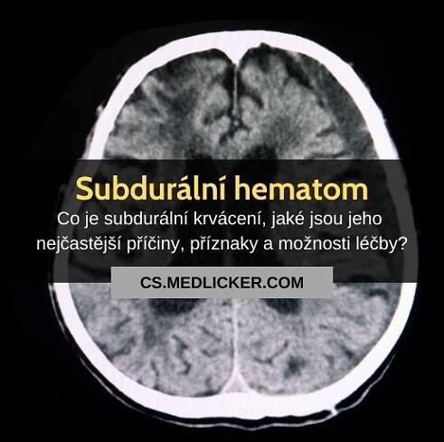 Subdurální hematom: příčiny, příznaky, diagnostika a léčba