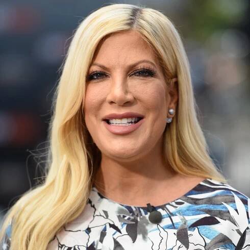 Tori Spelling Transformed from a Teen Icon to a Mother of 5: Before and After Plastic Surgery Photos