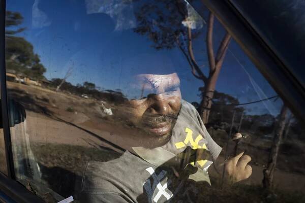  Eight stitches across the forehead after an altercation the night before in Wilcannia, NSW. 