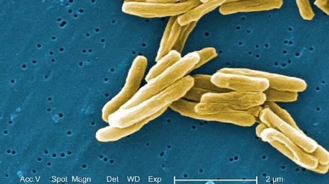 Mycobacterium tuberculosis