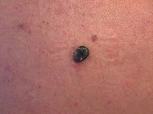 Dermatologie – Wikipedia