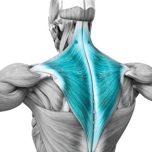 trapezius muscle knots
