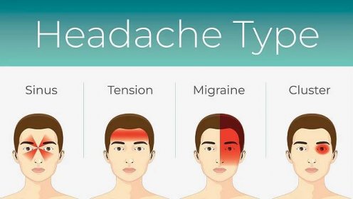 Bolest hlavy za očima a na čele: příčina a léčba