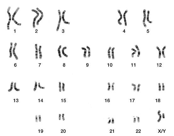 Karyotyp – Wikipedia