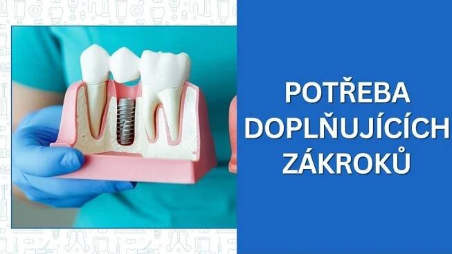 Potřeba doplňujících zákroků