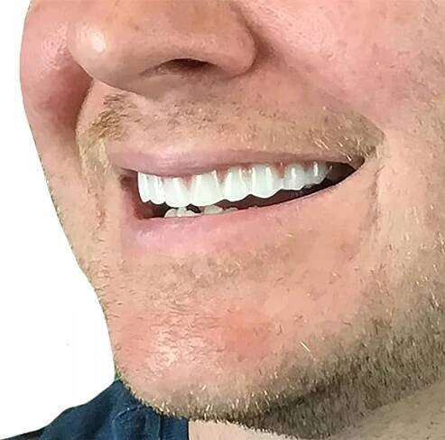 UMĚLÉ CHYBĚJÍCÍ zuby s dásněmi HORNÍ UMĚLÁ ČELIST protéza HORNÍ+ PL Stav balení originální