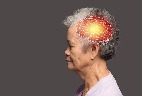 Dementia Crisis: China Faces Explosive Rise in Alzheimer’s Disease