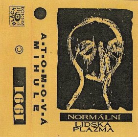 Atomová Mihule - Normální lidská plazma (1991) - Kali Music