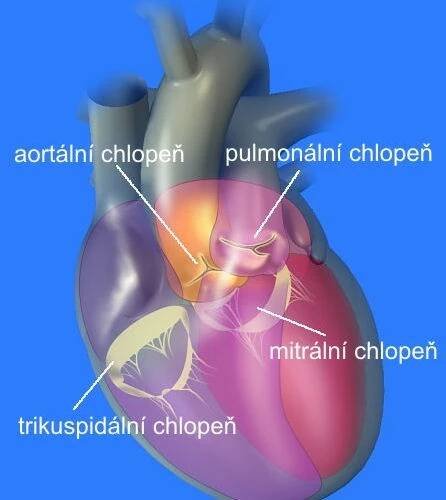 V Č. Budějovicích volí metodu výměny srdečních chlopní na míru pacientům
