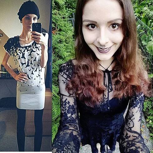 Julie trpěla anorexií. Aby nemusela jíst, schovávala si jídlo do uší
