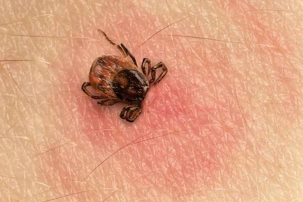 Jak rozpoznat příznaky boreliózy? Jen včasná léčba je účinná