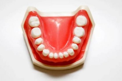 Falešné zuby dolní čelist pro výuku zubařů studentů. — Stock obrázek