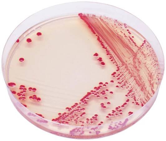 CHROMagar Acinetobacter
