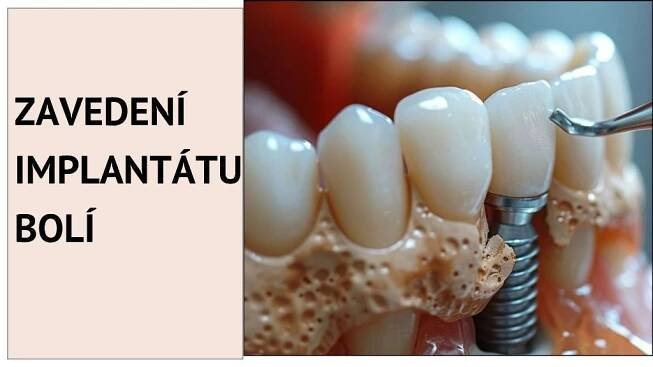 Zavedení implantátu bolí