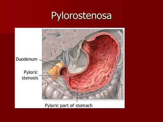 PPT - Poruchy a nemoci trávicí soustavy PowerPoint Presentation, free download - ID:819313