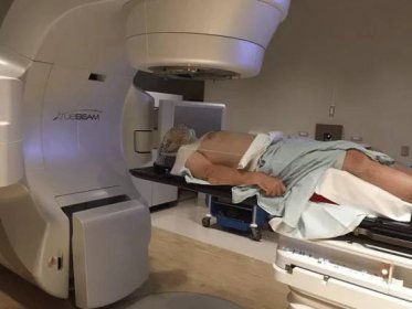Man using Stereotactic Body Radiation Therapy (SBRT)