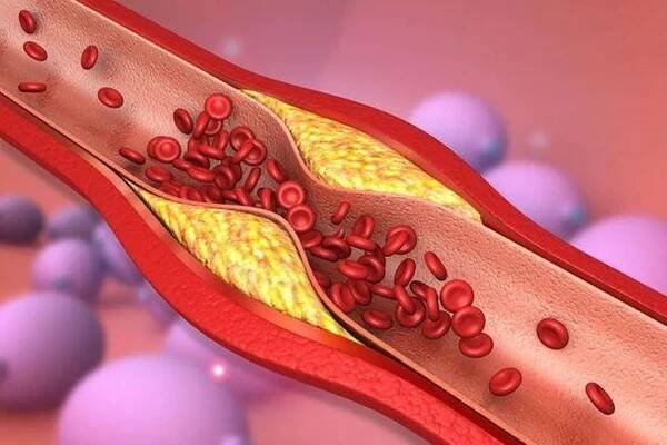 Cholesterol superfood that unclogs arteries is 'better than aspirin' doctor says