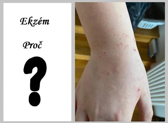 detoxikace-vyziva.cz - CENTRUM MODERNÍ DIAGNOSTIKY, testování parazitální zátěže a doporučení léčby