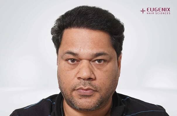 AJAY SHARMA Front After