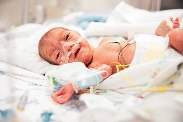 Een kosteloze, liefdevolle fotoreportage op de dienst neonatologie - Kleine held VZW