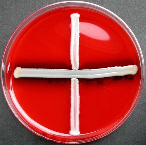 Methylene Blue stain