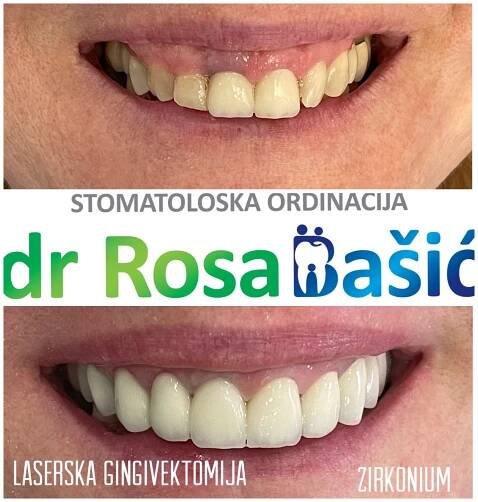 Before & After - Dental Office Dr Rosa Bašić