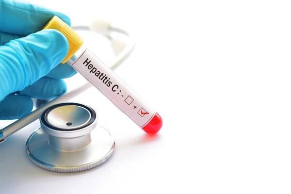 Call for Hepatitis C to be eliminated in SA
