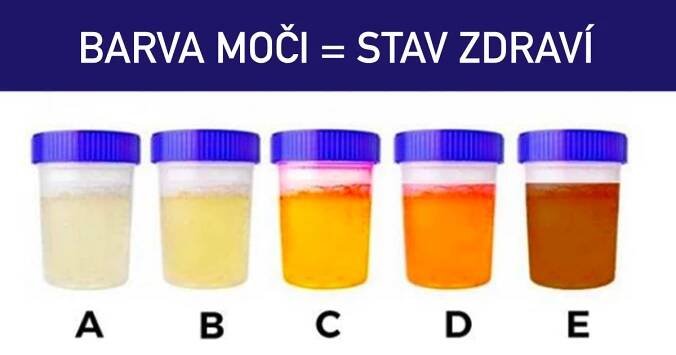 Tyto barvy moči vám říkají, kolik vody byste měli vypít, a také vysílají důležité signály o nemocech ve vašem těle