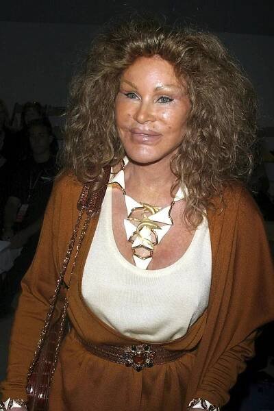 Zemřela »kočičí žena« Jocelyn Wildensteinová, milovnici plastik bylo 84 let