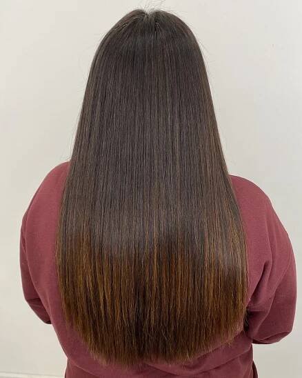 Laser Hair Removal Cambridge