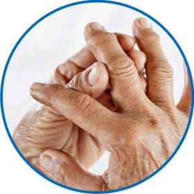 Revmatoidní artritida :: ČESKÉ CENTRUM ZDRAVOTNÍ PREVENCE