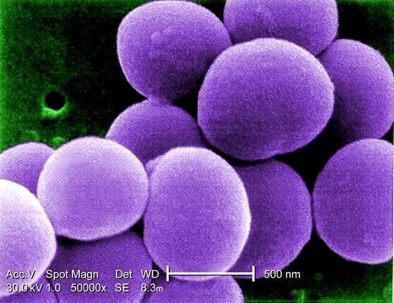 kmen, staphylococcus aureus, bakterie, vankomycin, středně pokročilý, odolný, kultura