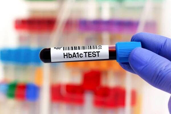Glykovaný hemoglobin – proč je důležité ho sledovat?