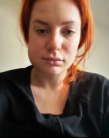 FOTO: Kateřina měla v puse obrovský zánět. – stránka 99