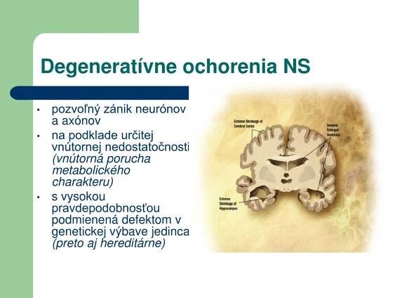 PPT - Neurológia PowerPoint Presentation, free download - ID:951310
