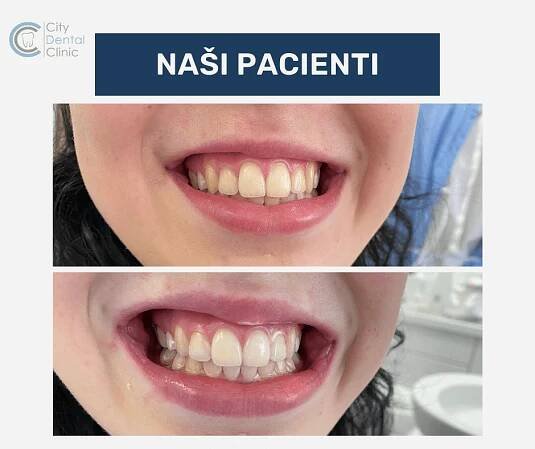 pred a po fotky nasich pacientov