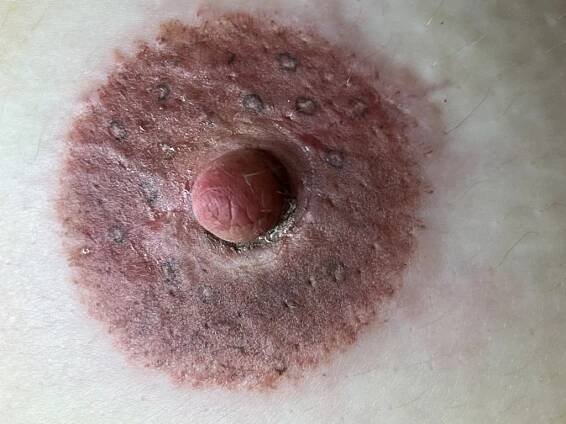 Areola permanentný make-up - Kozmetika Bratislava, permanentný make-up, oxygenoterapia, masáže