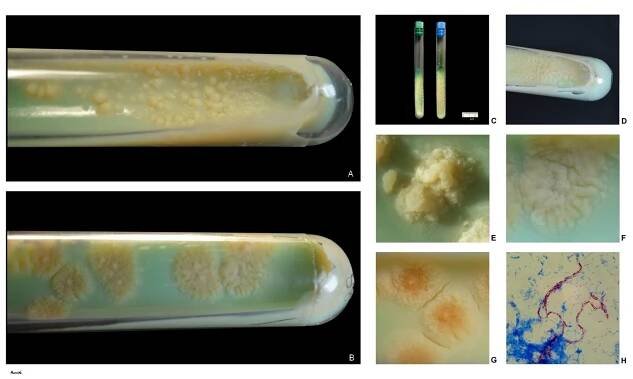 Soubor:M.tuberculosis.jpg