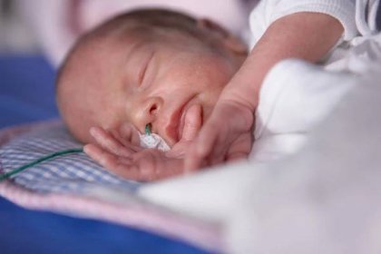 Příslušenství pro monitorování novorozenců Příslušenství pro neonatální péči
